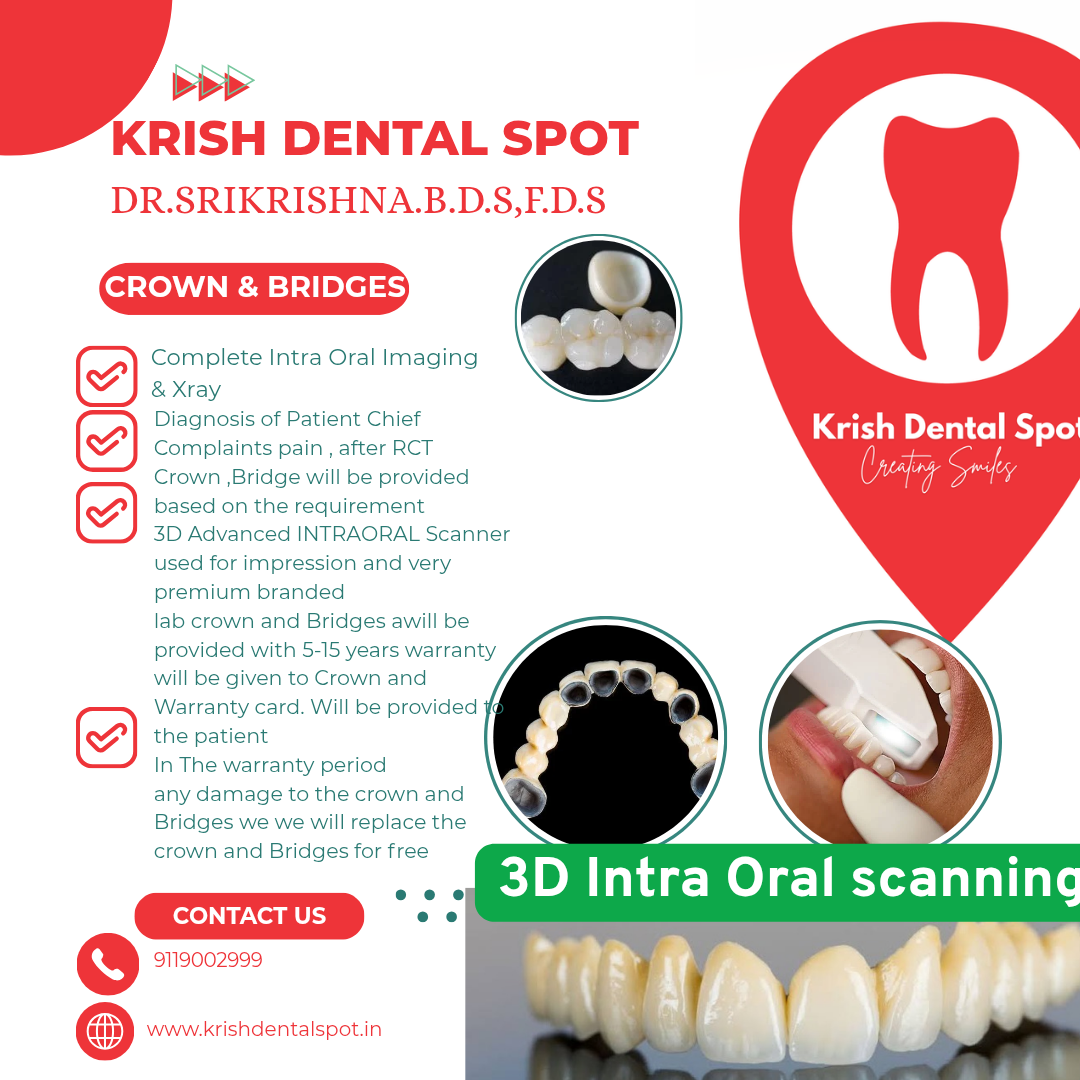 Dental Crowns & Bridges