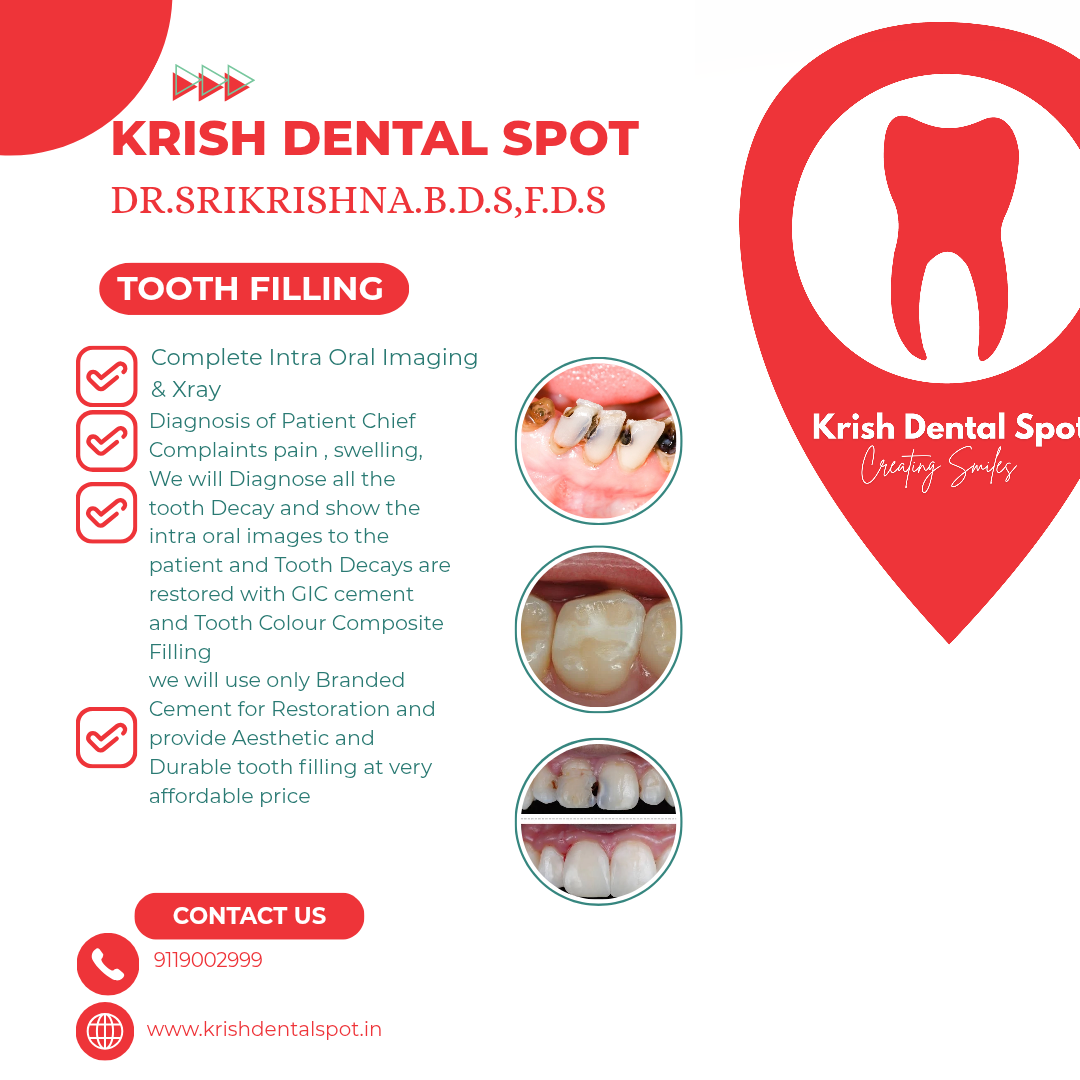 ooth Filling Treatment