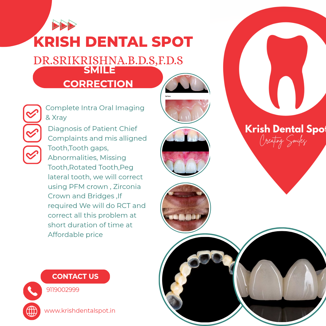 Smile Correction Treatment