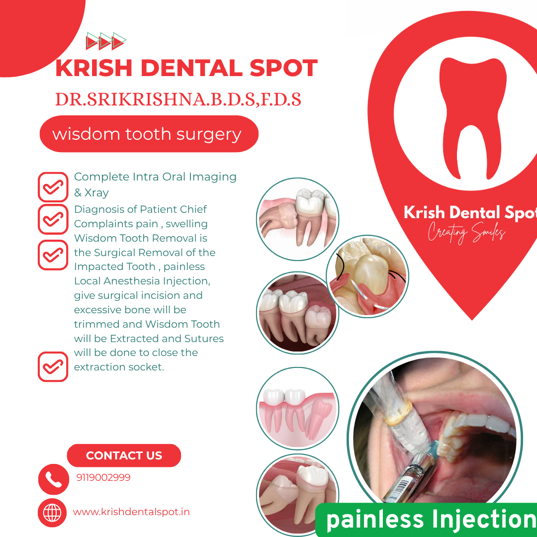 Wisdom Tooth Removal