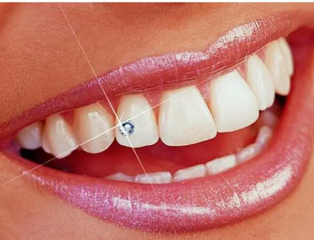 Tooth Jewellery Services
