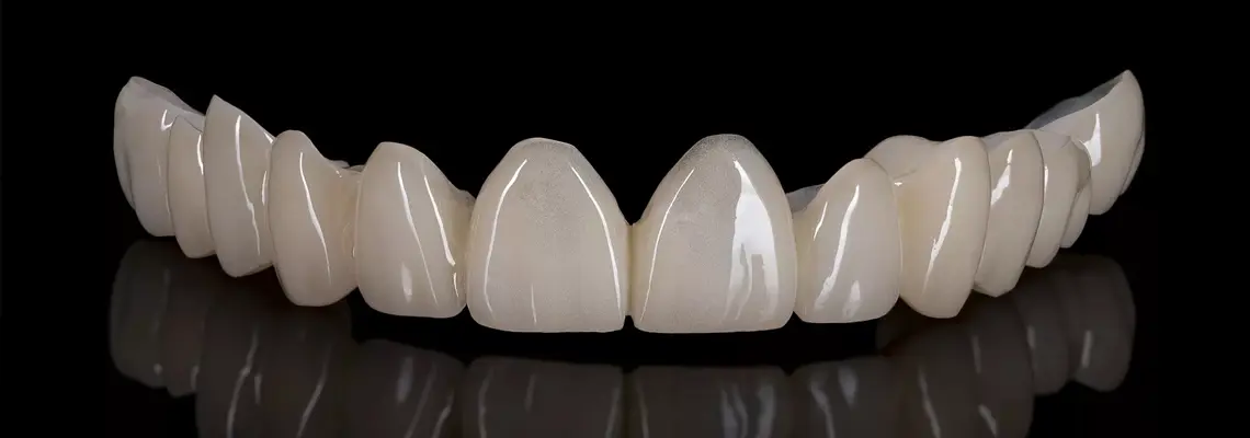 Smile Correction Treatment