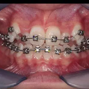 Expert Dental Care