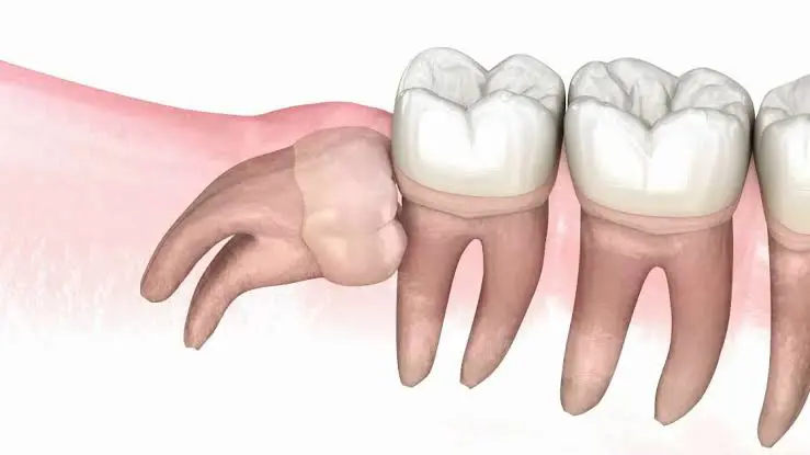 Expert Dental Care